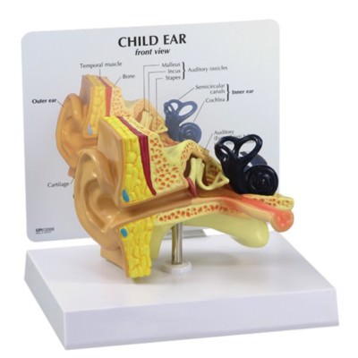 Child Ear w Otitis Media GPI Model Key Card LFA #2300 Make an Offer! SEE VIDEO