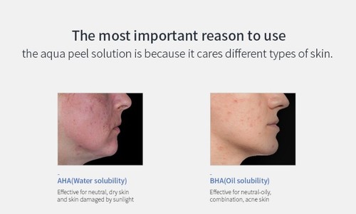 ABELUNA / Aqua Peeling Machine Home Care Skin Beauty / skin care / home care - Picture 7 of 12