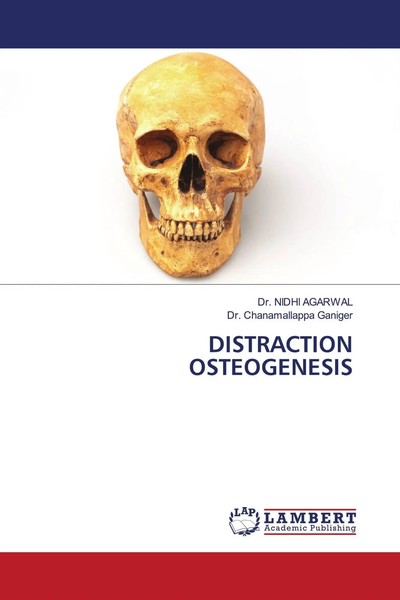 Nidhi Agarwal (U. A.) | Distraction Osteogenesis | Taschenbuch | Englisch (2022)-image