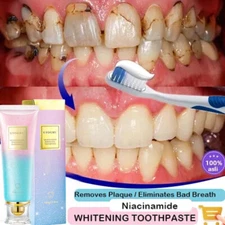 100ml Niacinamide Whitening Toothpaste, Natural Niacinamide Toothpaste Whitening