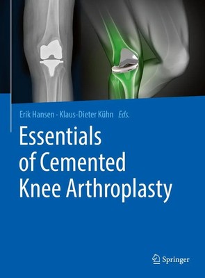 Erik Hansen (u. a.) | Essentials of Cemented Knee Arthroplasty | Buch | Englisch
