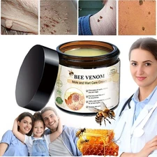 2026 Bee Venom Skin Tag Removal Treatment Cream Body Care Mole Corn Wart Remover