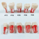 10Pcs Dental Root Canal Teeth Study Practice Model for Endodontic RCT File Molar