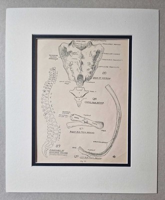 A. BIRMINGHAM Human Spine, Coccyx & Ribs - 1903 Anatomical Diagram