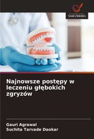 Najnowsze Post¿Py W Leczeniu G¿¿Bokich ZgryzóW Gauri Agrawal