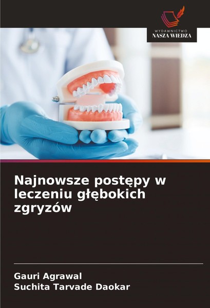 Najnowsze Post¿Py W Leczeniu G¿¿Bokich ZgryzóW Gauri Agrawal-image