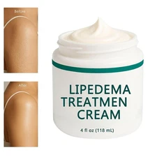 Lipedema Treatment Cream for Lipedema, Cellulite and Stretch Marks P6R4 N4L V1F6