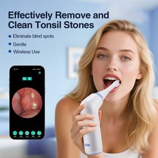 Electric Visual Tonsil Stone Remover Kit LED Light Vacuum Tonsil Stone Cleaner