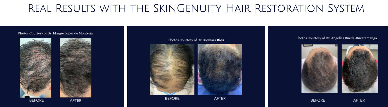 Empress Restorative Solution Hair Restoration 6 × 5ml – Growth Factors