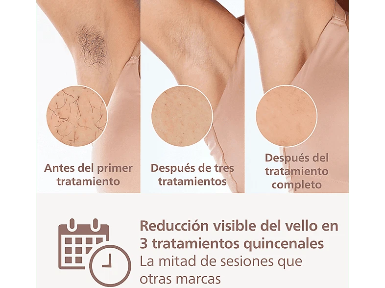 Depiladora IPL-Philips Lumea S8000 BRI945, Luz pulsada, 2 cabezales, Cara-cuerpo - Imagen 3 de 4