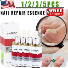 1-5Pcs Anti Fungal Nail Treatment Nail Finger Toe Fungus Onychomycosis Remover