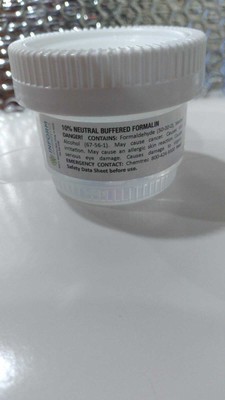 Plasticware - Specimen Container