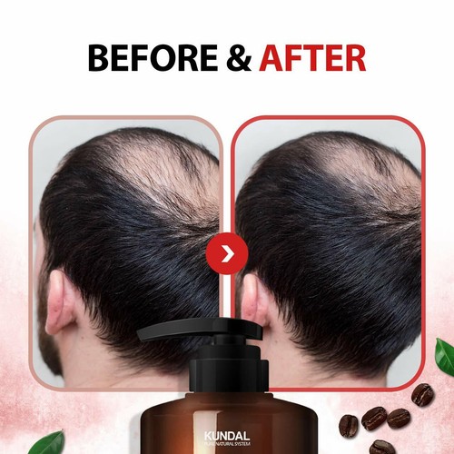 KUNDAL Natural Caffeine & Intensive Scalp Care Shampoo 500ml Hair Loss K-Beauty - Picture 10 of 17
