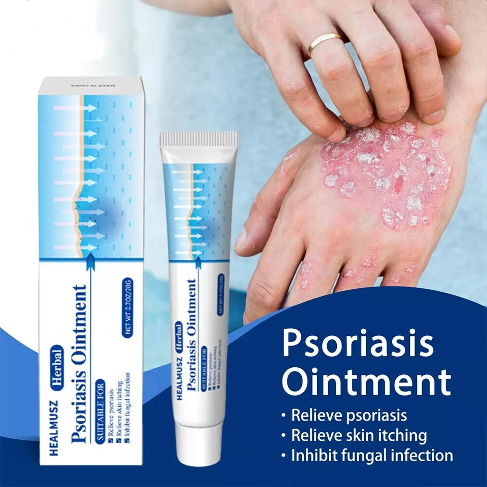 Natural Psoriasis Cream for Dermatitis Eczematoid Eczema Skin Ointment Treatment