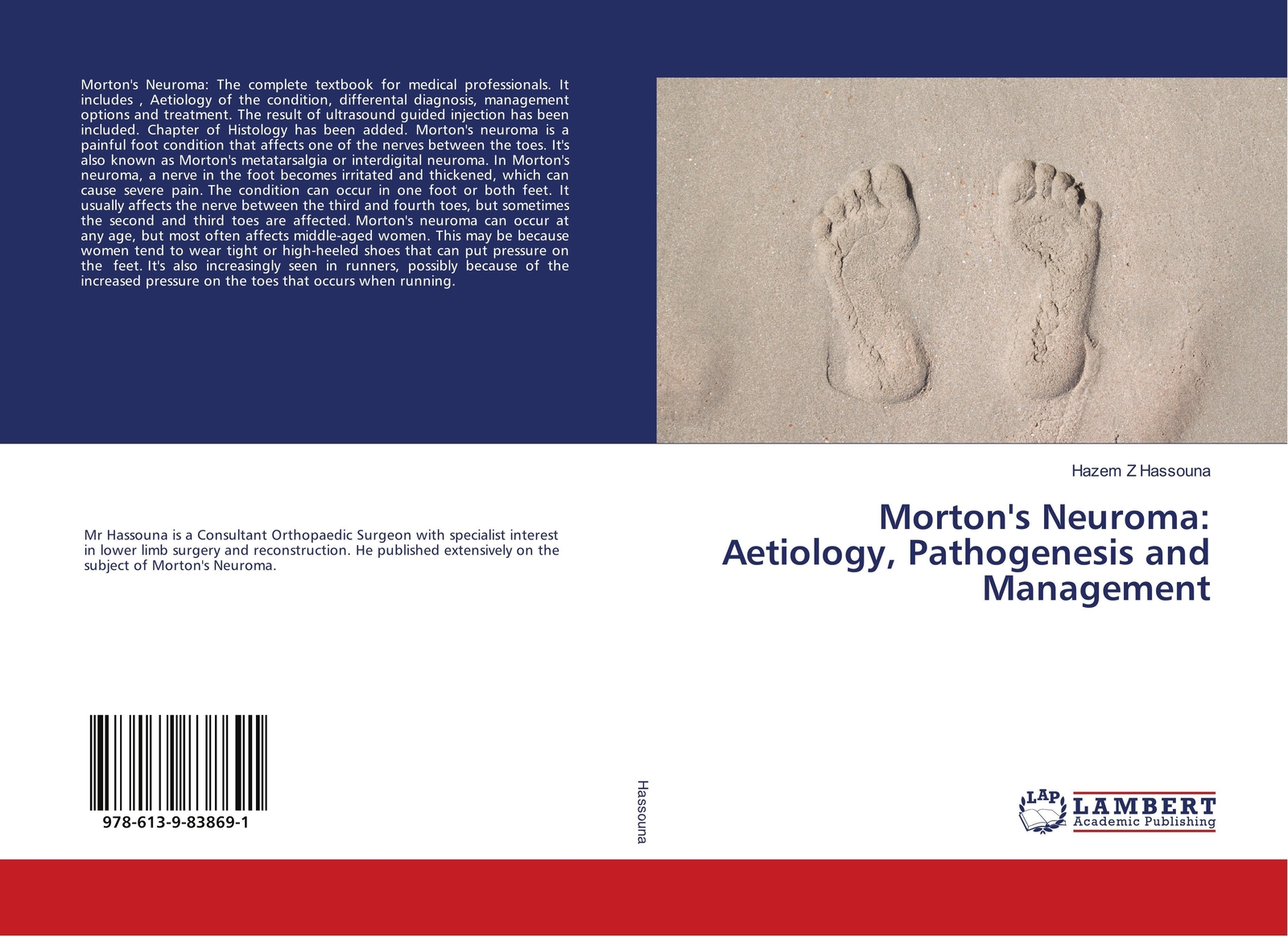 Hazem Z Hassouna | Morton's Neuroma: Aetiology, Pathogenesis And