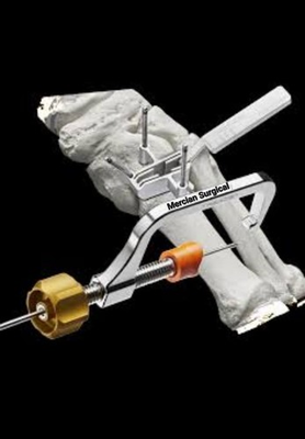 #ad #ad Micro Lapiplasty System Bunion Correction Minimally Invasive Stainless Steel $245.00