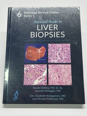 Pathology Surival Guides Series 1 / Liver Biopsies HC