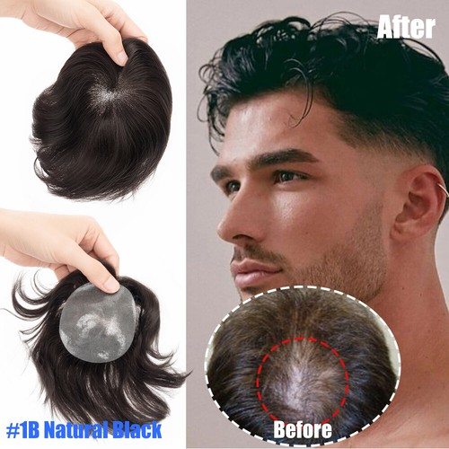 Toupet Echthaar Mini Ersatzsystem Ultradünne Haut PU für kahle Stellen 8*8cm - Bild 23 von 42