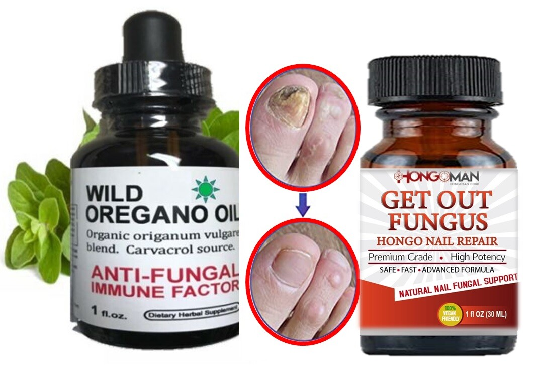 100 Natural toenail support fungus oregano oil Hongos fungi support eBay