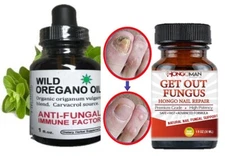 100% Natural toenail support fungus oregano oil Hongos fungi support