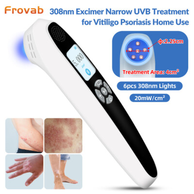 ボディ・フェイスケア UVB LIGHT THERAPY DEVICE UL-01 308nm s-l400.jpg