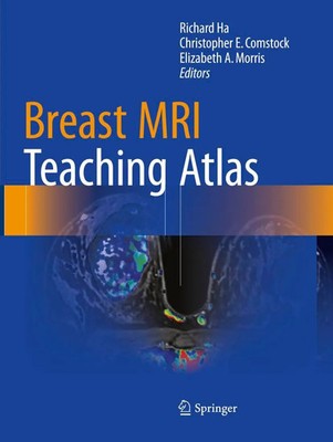 Richard Ha (u. a.) | Breast MRI Teaching Atlas | Taschenbuch | Englisch (2018)