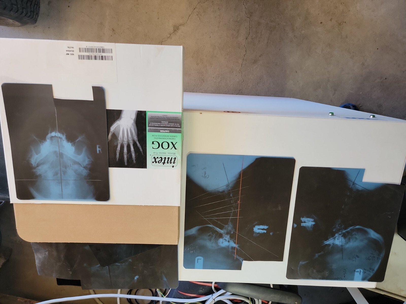 SCRAP XRAY FILM 25lbs (Silver Recovery/Teaching) EXPOSED eBay