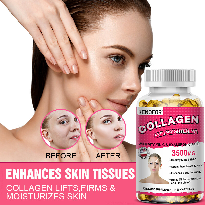 Glutathione Collagen Glow Anti-aging skin Whitening 30 To 120 Capsules for  Women | eBay