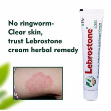 Ayurvedic Treatment for Ringworm, Anti Itching, & Anti Fungal Infections