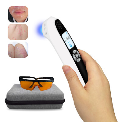 308nm UVB Light Phototherapy Light Therapy for Skin 0-5J/cm2 Adjustable 45mW/cm2