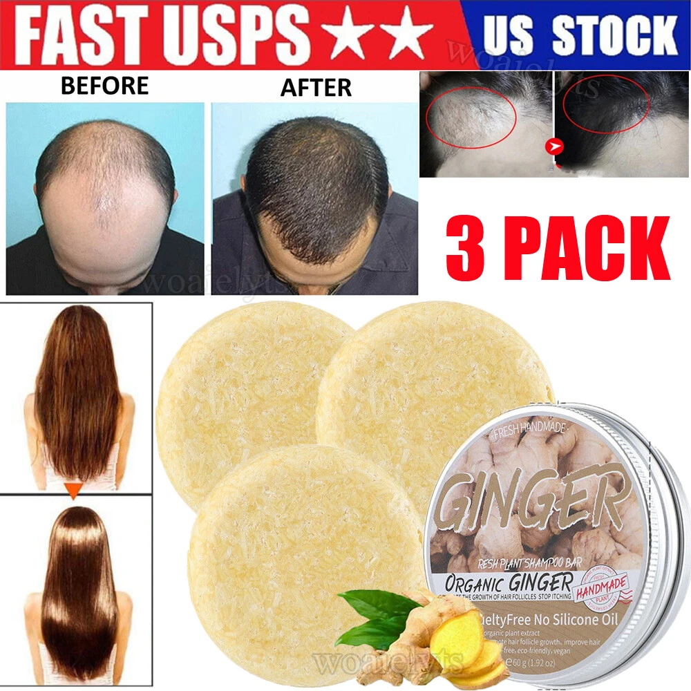 Top 149+ ginger juice for hair growth ceg.edu.vn