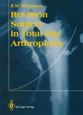 Boguslaw M. Wroblewski | Revision Surgery in ...