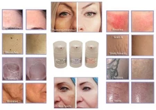 Gel de tratamiento, paquete de 3 para depiladora permanente cabello, láser Co2.