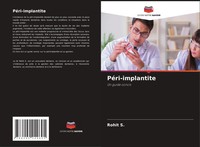 Rohit S. | PéRi-Implantite | Taschenbuch | FranzöSisch (2021) | Un Guide Concis