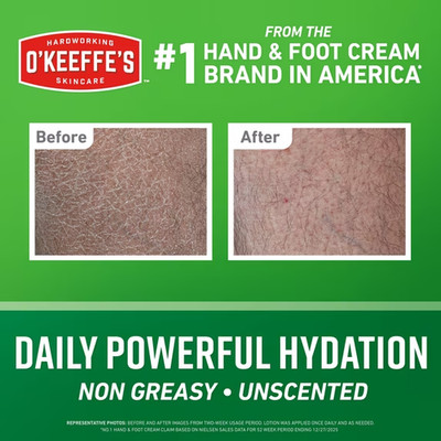 O Keeffe's Working Hands Hand and Body Lotion 12 Fl Oz Hydrates Dry Skin