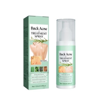 Akne Spray für Körper 120 ml natürlicher Hautpflege gegen Pickel