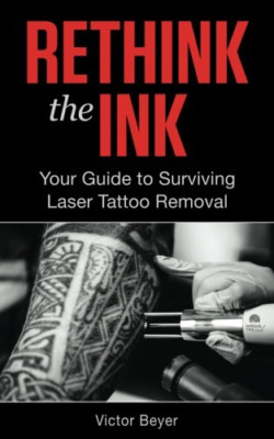Überdenken Sie die Tinte: Ihr Leitfaden zum Überleben von Laser Tattoo R - Taschenbuch NEU Beyer, V