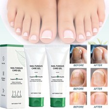 5Pcs Nutraboost Nail Fungus Treatment Gel,Nail Fungus,Fungus Cream US -20 OFF 