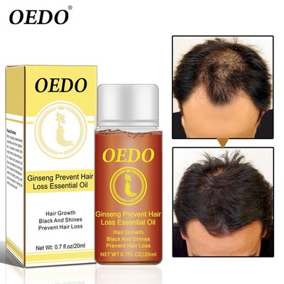 Natural Ginseng Hair Growth Oil Prevent Hair Loss Liquid Fast