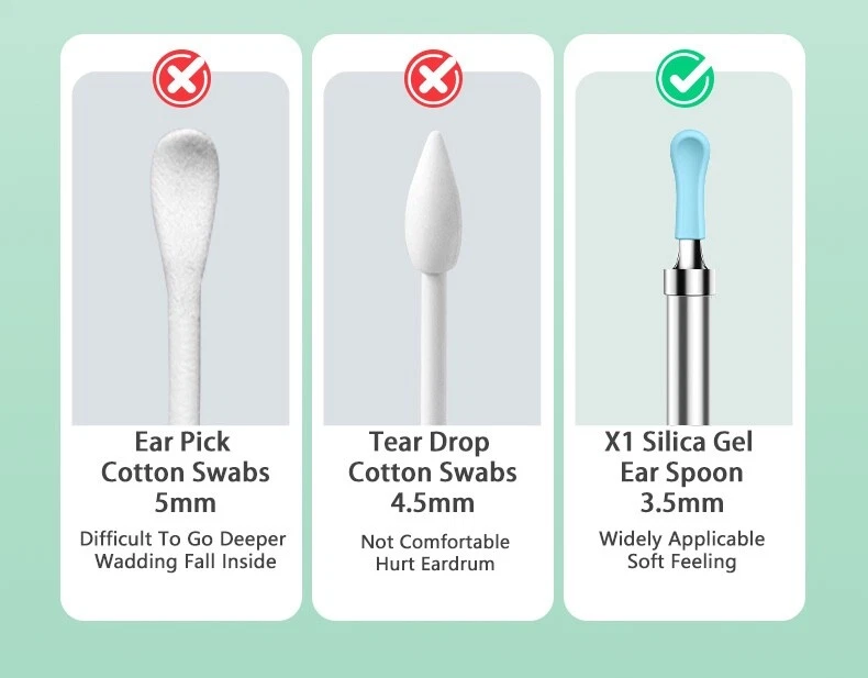 Limpiador de oídos Herramienta de eliminación de cera de oído con cámara Luz LED Otoscopio Kit de limpieza de oídos Foto 4 de 4