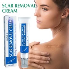 Scar Removal Cream Skin Repair Acne Treatment Fade Stretch Markers Burns hot