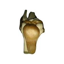 Used Merck Dolobid Functional Knee Joint Anatomical Model