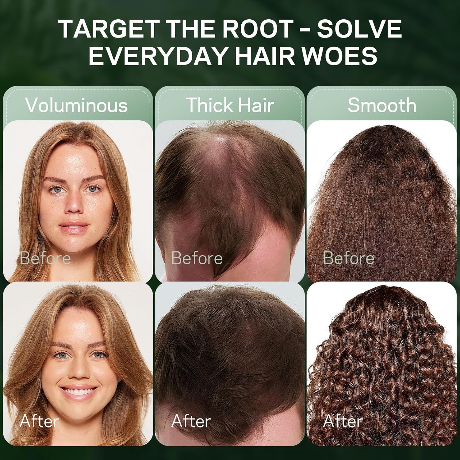 Rosemary & Hydrolyzed Keratin Hair Growth Shampoo, Organic Natural Shampoo... 