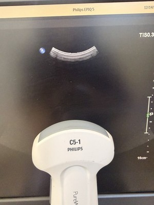 Philips C5-1 Curved Array Ultrasound Transducer | Tested| 60-Day Warranty | 0HRC