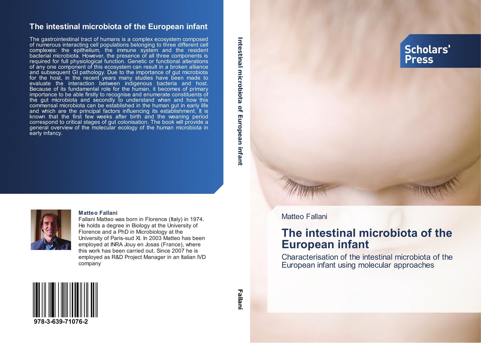 Thumbnail - Matteo Fallani | The Intestinal Microbiota Of The European Infant |