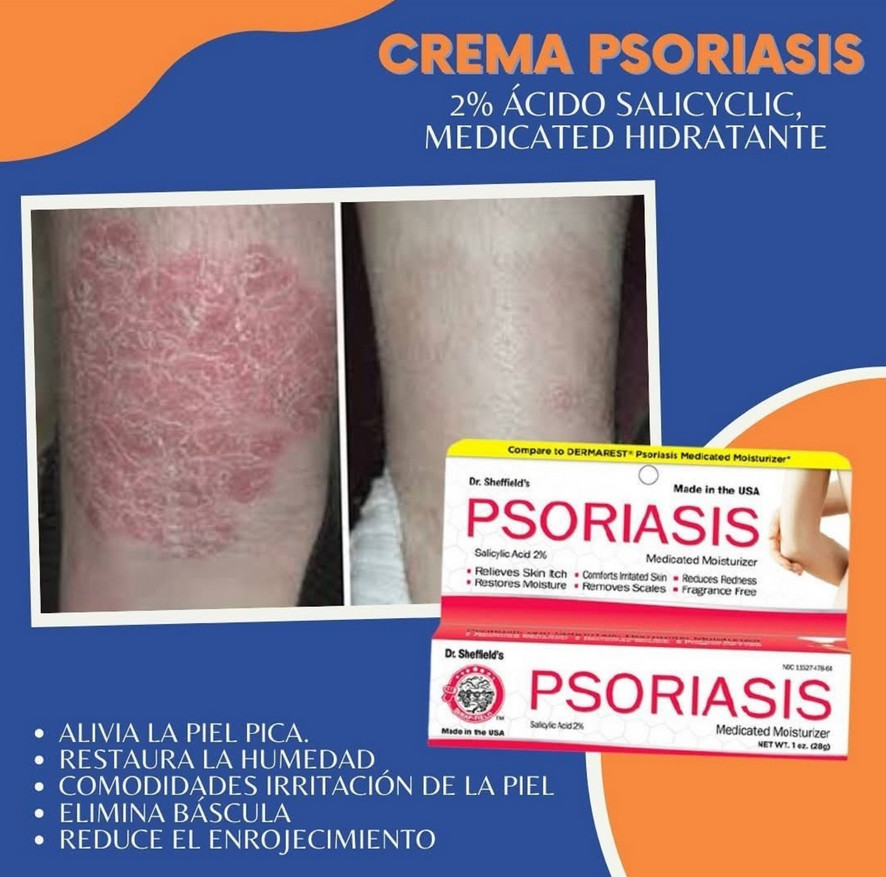 NUEVO Mejor tratamiento medicina para la soriasis ayuda crema contra la psoriasis