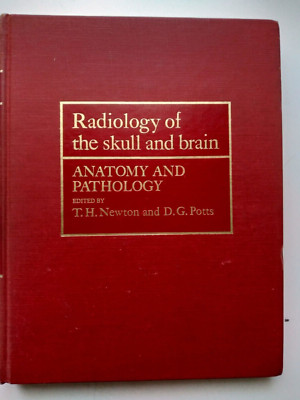 radiologie des schädels und gehirns newton töpfe
