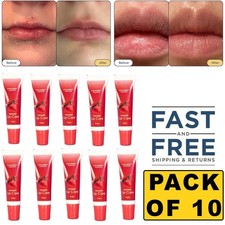 10 x Lip Balm Remedy - Hydrating and Healing Ointment Repairs Dry, Cracked Lips