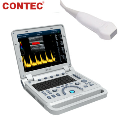 Color Doppler Ultrasound Scanner Cardiac Machine + Phased Array Probe Heart Exam