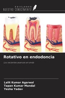 Lalit Kumar Agarwal (U. A.) | Rotativo En Endodoncia | Taschenbuch | Spanisch